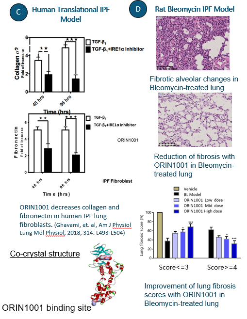 A poster with graphs and data about the effects of fibromyalgia.